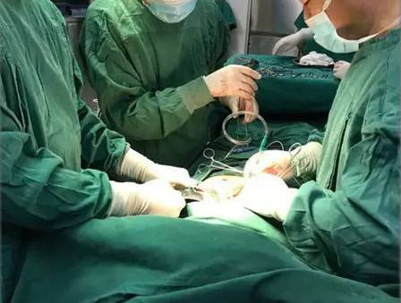 多年未重视，胆囊竟变成了“小瓷瓶儿”?