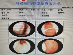 鼻塞打鼾流鼻涕3年，只用一招就搞定