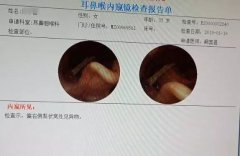 陈女士被猪骨头卡喉 深圳万丰医院医生成功取出异物